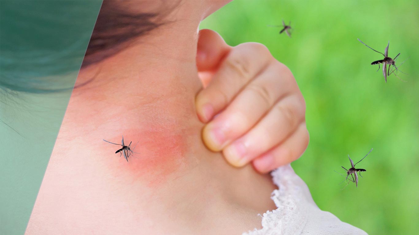 alergia a insetos